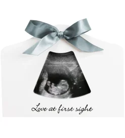 Dooky Plakater Og Billeder>Ultralydsbillede ramme